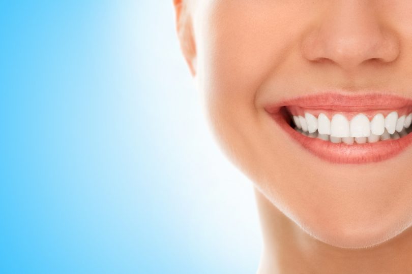 comment se passe la pose d'un implant dentaire